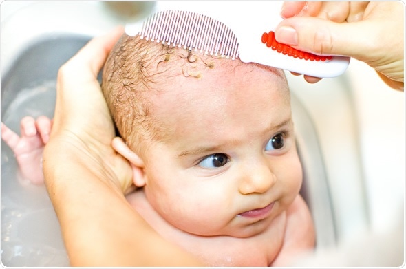 Cradle cap comb - Image Copyright: Luca Lorenzelli / Shutterstock